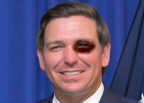 Ron DeSantis with self-inflicted black eye.